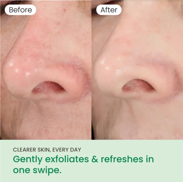 NoMorePorePads-4 NoMorePorePads-4