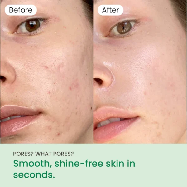 NoMorePorePads-7 NoMorePorePads-7