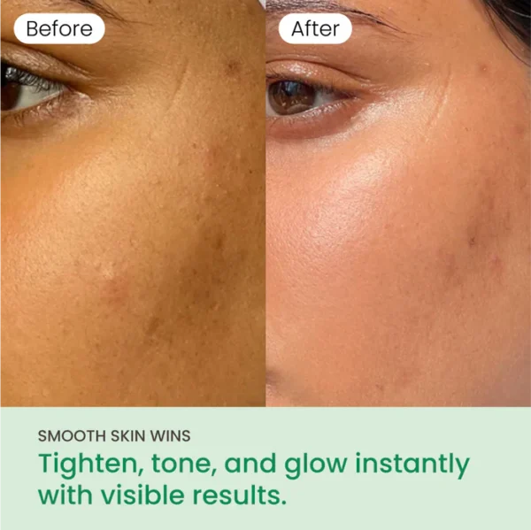 NoMorePorePads-9 NoMorePorePads-9